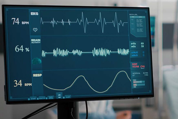 Telemetry monitor displaying patient heart rhythm and vital signs